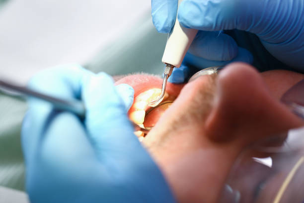 Best Emergency Treatment for Dental Infections or Abscesses in Kohler, WI